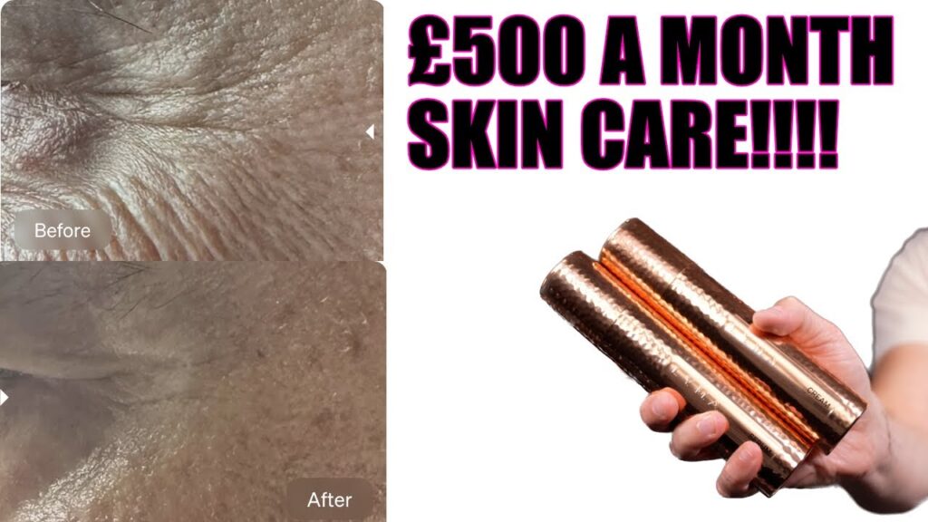 I TRIED THE £500 A MONTH LYMA SKINCARE!!!!! LET THE RESULTS BEGIN!?!?!