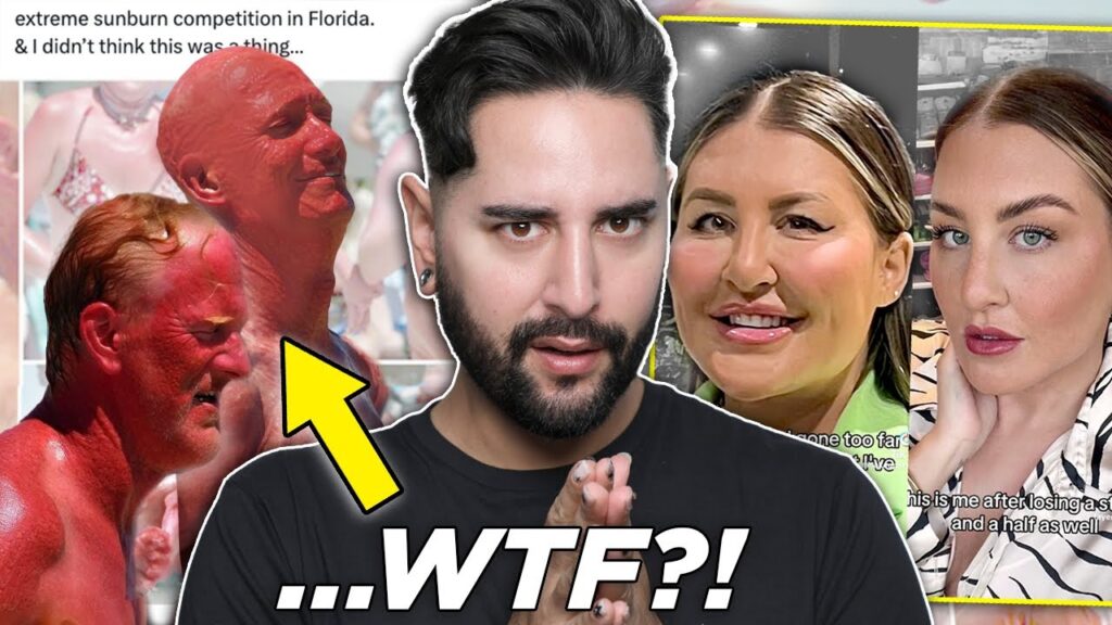 Florida's EXTREME Sunburn Competition, Influencers Being Stupid & Filler Melting! UGLY BEAUTY NEWS!