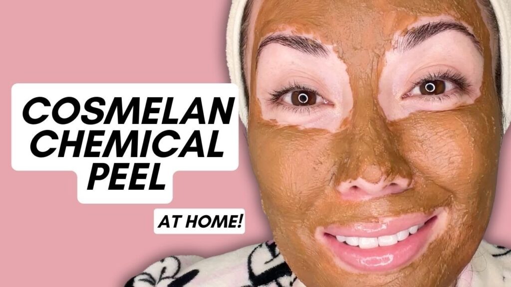 I Did a Cosmelan Chemical Peel at Home!



I Did a Cosmelan Chemical Peel at Home!